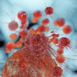 cancer research, cancer, discoveries, treatments, progress, types of cancer, fighting cancer, cancer scientists